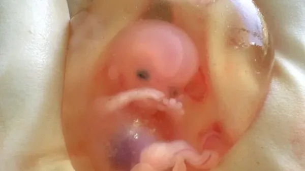 Barbarische Forschung mit menschlichen Föten: Fötus in Fruchtblase